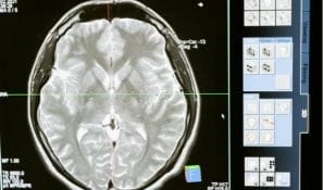 medical imaging and radiology